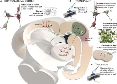 Neuronal Replacement in Stem Cell Therapy for Stroke: Filling the Gap